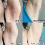 Collagen Underarm Whitening Cream for Dark Skin, Bleaching Underarm Intimate Area Skincare Products - Image 4