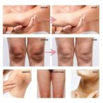 Collagen Underarm Whitening Cream for Dark Skin, Bleaching Underarm Intimate Area Skincare Products - Image 5